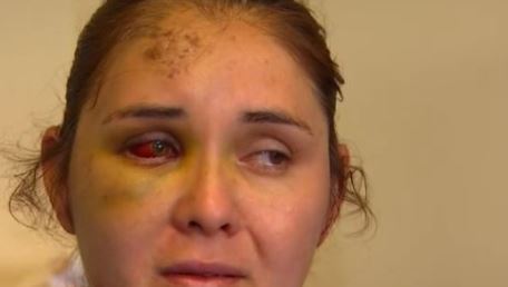 N.J. mom allegedly beaten up by 13-year-old after she complained about boys bullying her son